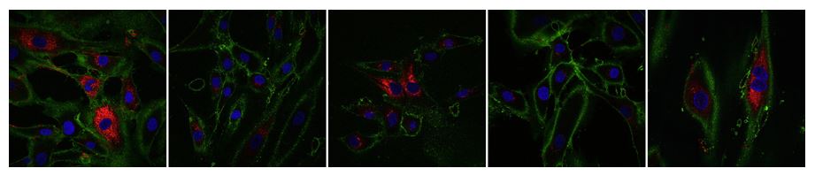 Омоложение на 30 лет. Опыты.